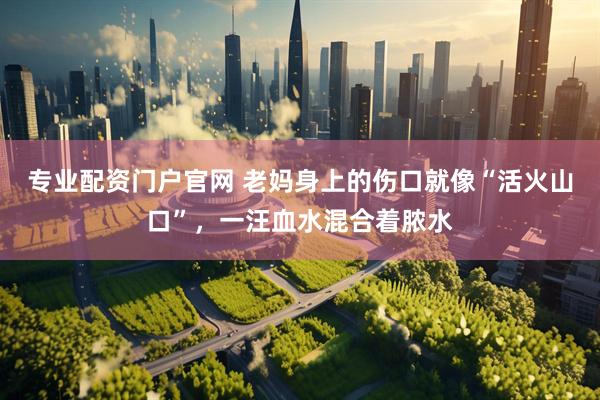 专业配资门户官网 老妈身上的伤口就像“活火山口”，一汪血水混合着脓水